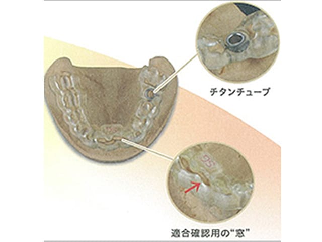 サージカル図解