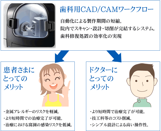 歯科用CAD／CAMワークフロー